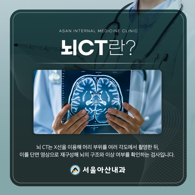 뇌 CT란 무엇인가