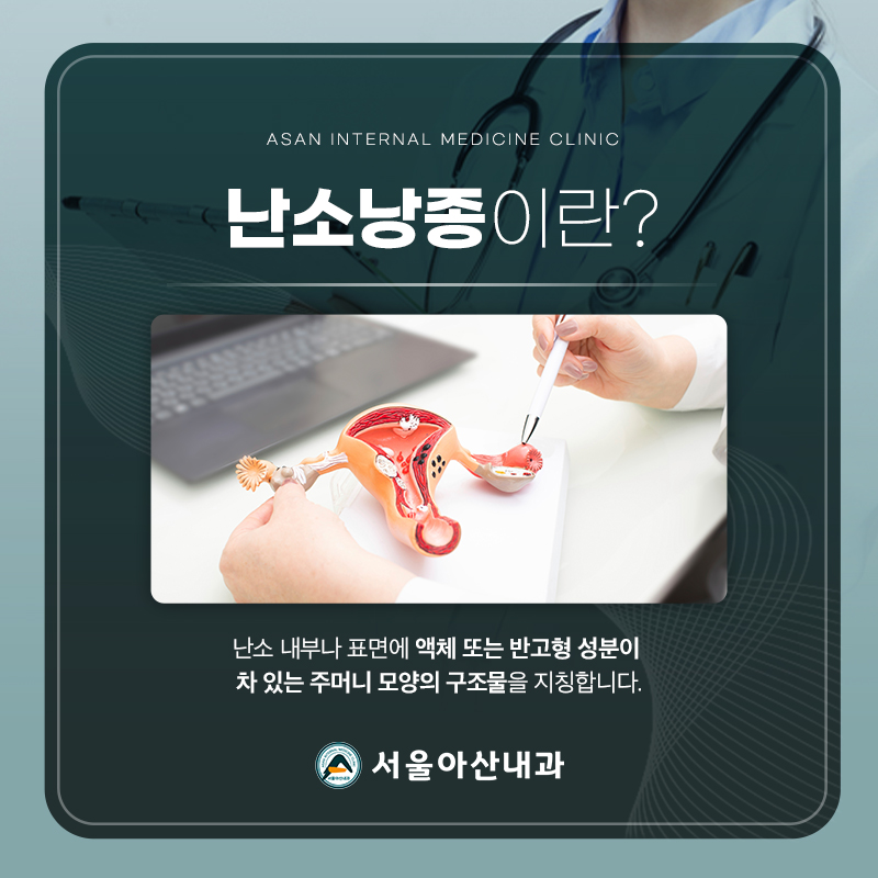 난소낭종 이미지1