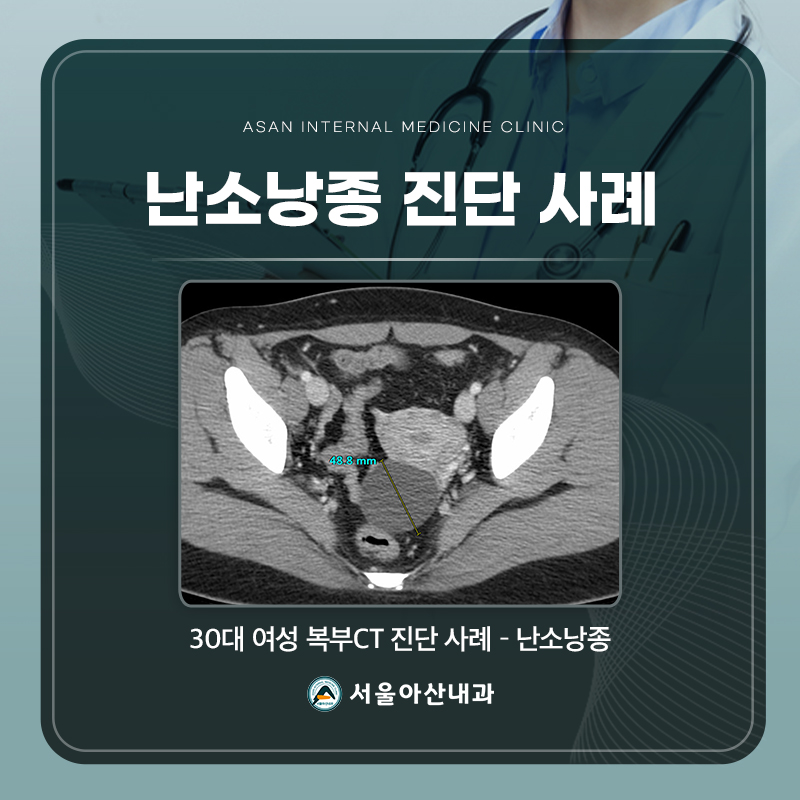 복부CT 사례 이미지 2