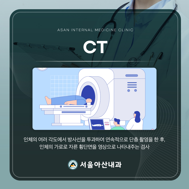 난소낭종 이미지4