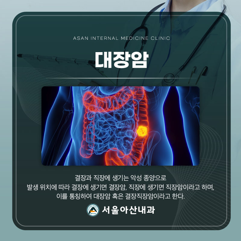 대장암이란